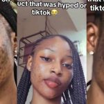 Lady shares shocking skin reaction after using hyped TikTok skincare product