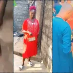 Mother's leg swollen after being warned not to attend daughter's wedding