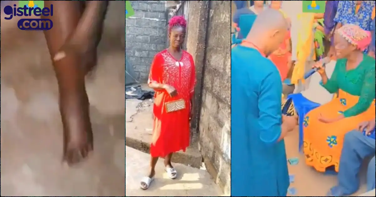 Mother’s leg swollen after being warned not to attend daughter’s wedding