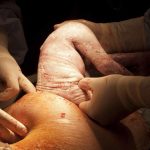BREAKING: FG Announces Free Cesarean Sections for Pregnant Women in Nigeria