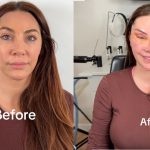 "We watch we don't judge" – Online búzz as lady shares before and after plastic surgery (IMAGES)