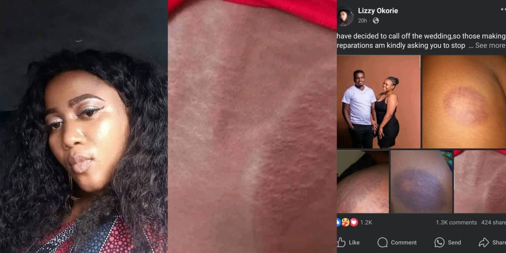 Lady cancels wedding over fiancé’s physical abuse