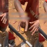 "Which one is the middle finger ?" – Man astonished to discover boy with six fingers (WATCH)