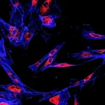 Study reveals how fatty liver disease leads to liver cancer